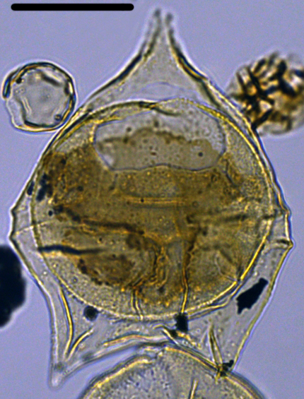 Deflandrea oebisfeldensis Doe27X2012051115b.jpg